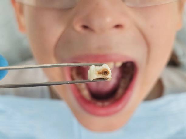 Best Pediatric Emergency Dentist in Peoria, IL